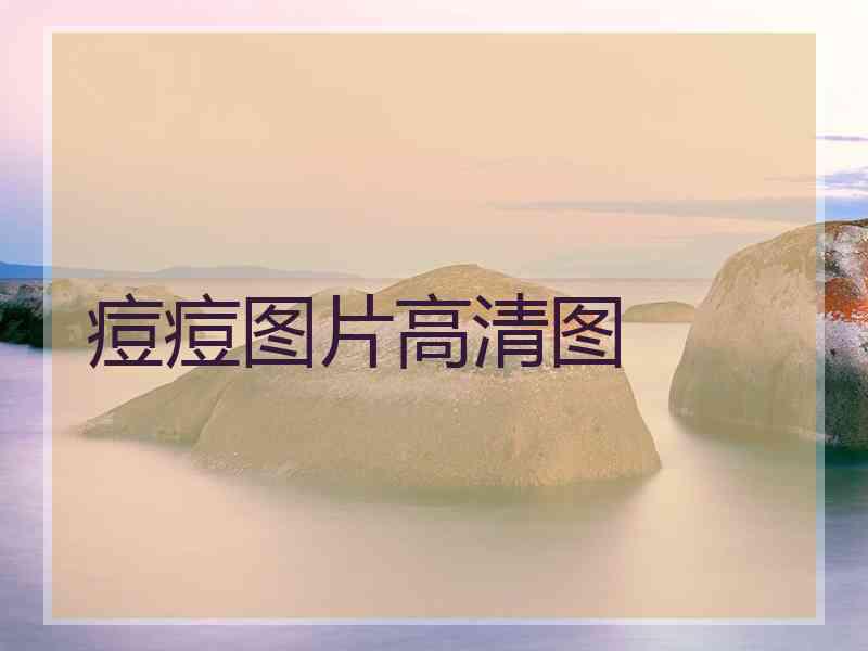 痘痘图片高清图